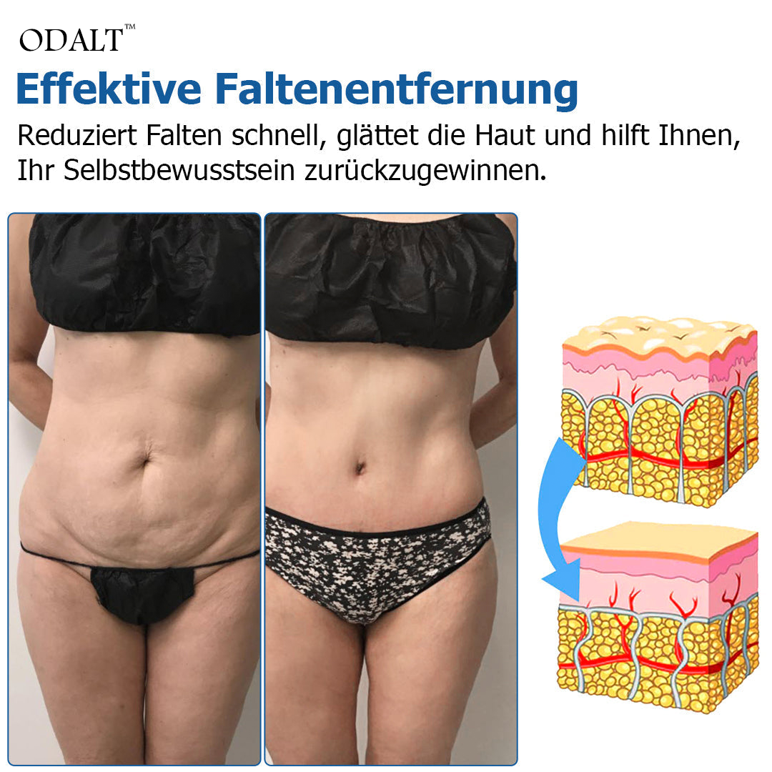 ODALT™ Thermische Zyklusformende Leggings - Hergestellt in Deutschland